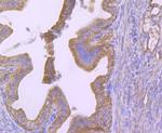 Cytokeratin 8 Antibody in Immunohistochemistry (Paraffin) (IHC (P))