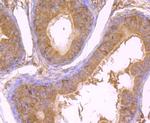 Cytokeratin 8 Antibody in Immunohistochemistry (Paraffin) (IHC (P))