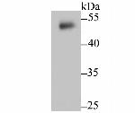 Cytokeratin 8 Antibody in Western Blot (WB)