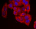 NME1 Antibody in Immunocytochemistry (ICC/IF)