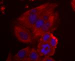 NME1 Antibody in Immunocytochemistry (ICC/IF)