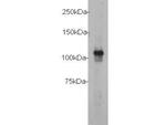 c-Myc Antibody in Western Blot (WB)