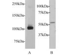 c-Myc Antibody in Western Blot (WB)