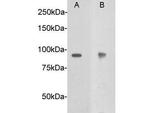 DCC Antibody in Western Blot (WB)