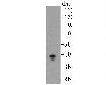 ST2 Antibody in Western Blot (WB)