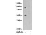 Protein C Antibody in Western Blot (WB)