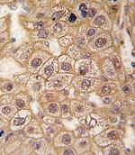 beta-2 Adrenergic Receptor Antibody in Immunohistochemistry (Paraffin) (IHC (P))