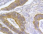 ARF1 Antibody in Immunohistochemistry (Paraffin) (IHC (P))