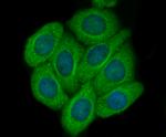 CD62E (E-selectin) Antibody in Immunocytochemistry (ICC/IF)