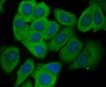 CD62E (E-selectin) Antibody in Immunocytochemistry (ICC/IF)