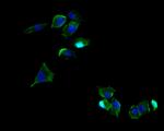 CD171 (L1CAM) Antibody in Immunohistochemistry (Paraffin) (IHC (P))