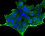 CD171 (L1CAM) Antibody in Immunohistochemistry (Paraffin) (IHC (P))