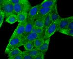 CD171 (L1CAM) Antibody in Immunohistochemistry (Paraffin) (IHC (P))