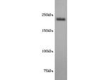 CD171 (L1CAM) Antibody in Western Blot (WB)