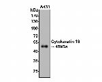 Cytokeratin 18 Antibody in Immunocytochemistry (ICC/IF)