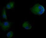 Cytokeratin 18 Antibody in Immunocytochemistry (ICC/IF)