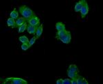 Cytokeratin 18 Antibody in Immunohistochemistry (Paraffin) (IHC (P))