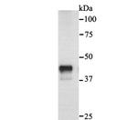 Cytokeratin 18 Antibody in Western Blot (WB)