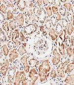 REA Antibody in Immunohistochemistry (Paraffin) (IHC (P))