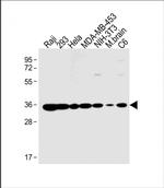 REA Antibody in Western Blot (WB)