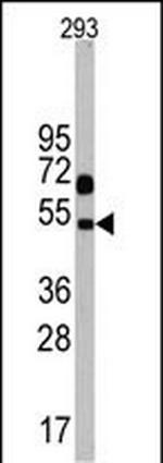 NPTX1 Antibody in Western Blot (WB)