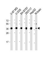 EN1 Antibody in Western Blot (WB)