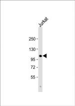 PARG Antibody in Western Blot (WB)