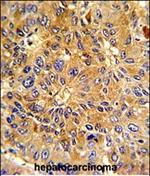 Cyclin A2 Antibody in Immunohistochemistry (Paraffin) (IHC (P))