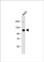 MCK10 Antibody in Western Blot (WB)