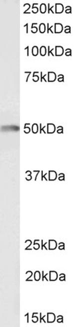 CSK Antibody in Western Blot (WB)