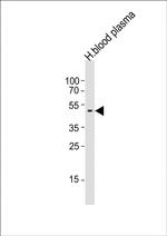 PEDF Antibody in Western Blot (WB)