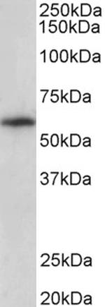 TXK Antibody in Western Blot (WB)