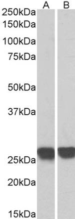 GRB2 Antibody in Western Blot (WB)