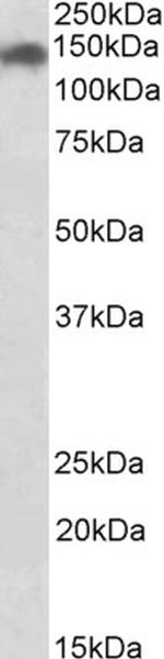 SMC2 Antibody in Western Blot (WB)