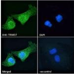 TRIM37 Antibody in Immunocytochemistry (ICC/IF)