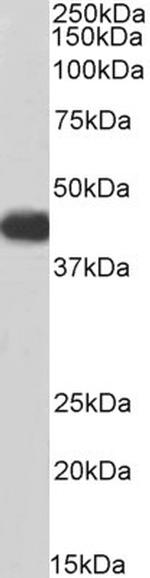 ACADM Antibody in Western Blot (WB)