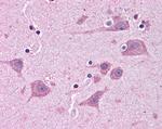 TAB182 Antibody in Immunohistochemistry (Paraffin) (IHC (P))