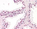 ZIC5 Antibody in Immunohistochemistry (Paraffin) (IHC (P))