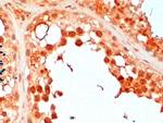 UBC3B Antibody in Immunohistochemistry (Paraffin) (IHC (P))