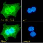 TRIM8 Antibody in Immunocytochemistry (ICC/IF)