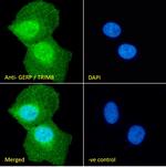 TRIM8 Antibody in Immunocytochemistry (ICC/IF)