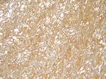 TRIM8 Antibody in Immunohistochemistry (Paraffin) (IHC (P))