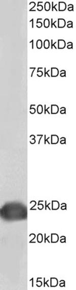 DJ-1 Antibody in Western Blot (WB)