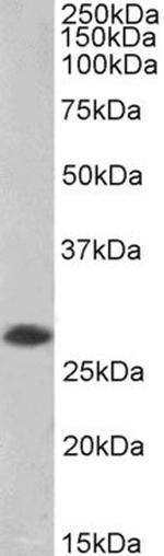 PHAPI2 Antibody in Western Blot (WB)