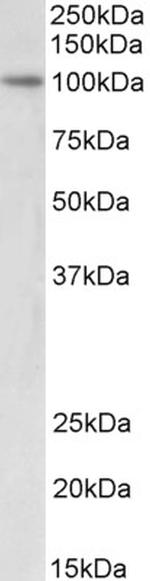 UHRF1 Antibody in Western Blot (WB)