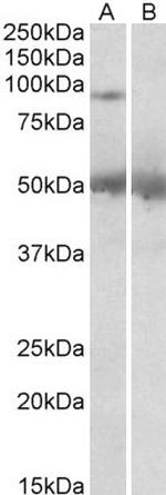 USP6 Antibody in Western Blot (WB)