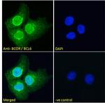 BCOR Antibody in Immunocytochemistry (ICC/IF)