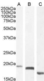 EDF1 Antibody in Western Blot (WB)