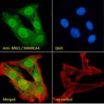 BRG1 Antibody in Immunocytochemistry (ICC/IF)