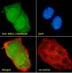 BRG1 Antibody in Immunocytochemistry (ICC/IF)